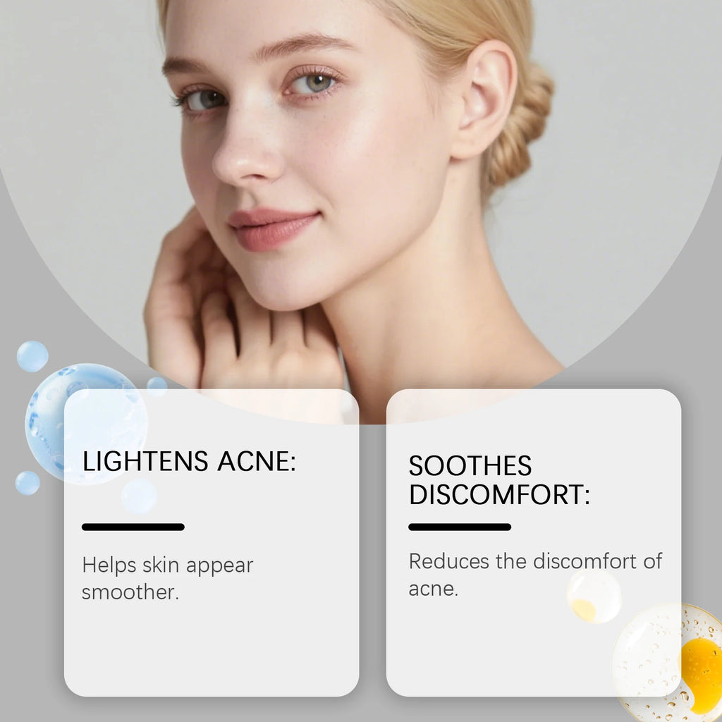 Hydrocolloid Pimple Patches – Clear Skin Support